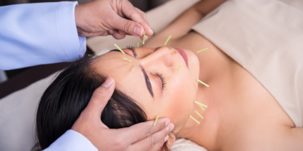 Accupuncture Therapy on a patient